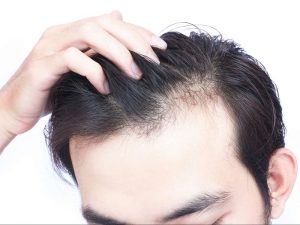 32rf39tuv5oyhn54ioyj5 300x225 تشخیص جنس مو | روش های تشخیص انواع مو (خشک، معمولی، چرب و...)